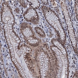 Invitrogen SH2D4B Polyclonal Antibody 100 &mu;L; Unconjugated:Antibodies,