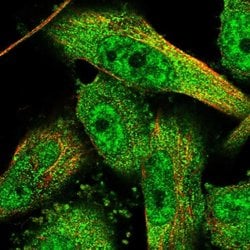 Invitrogen KIAA1468 Polyclonal Antibody 100 &mu;L | Buy Online | Invitrogen&trade; | Fisher Scientific