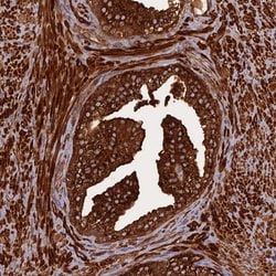 Invitrogen KIAA1468 Polyclonal Antibody 100 &mu;L | Buy Online | Invitrogen&trade; | Fisher Scientific