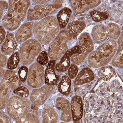 Invitrogen TBC1D30 Polyclonal Antibody 100 &mu;L; Unconjugated:Antibodies,