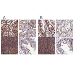 Invitrogen GOLGA3 Polyclonal Antibody 100 &mu;L; Unconjugated:Antibodies,