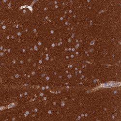 Invitrogen GOLGA3 Polyclonal Antibody 100 &mu;L; Unconjugated:Antibodies,