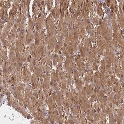 Invitrogen GOLGA3 Polyclonal Antibody 100 &mu;L; Unconjugated:Antibodies,
