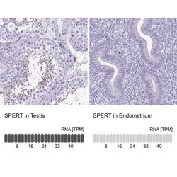 Invitrogen SPERT Polyclonal Antibody 100 &mu;L; Unconjugated:Antibodies,