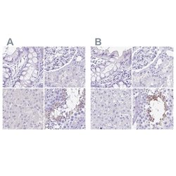 Invitrogen SPERT Polyclonal Antibody 100 &mu;L; Unconjugated:Antibodies,