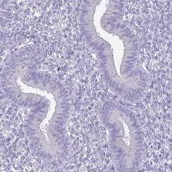 Invitrogen SPERT Polyclonal Antibody 100 &mu;L; Unconjugated:Antibodies,