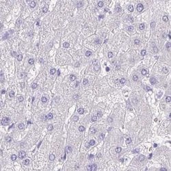 Invitrogen SPERT Polyclonal Antibody 100 &mu;L; Unconjugated:Antibodies,