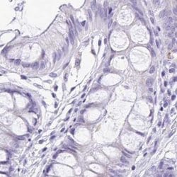 Invitrogen SPERT Polyclonal Antibody 100 &mu;L; Unconjugated:Antibodies,