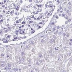 Invitrogen SPERT Polyclonal Antibody 100 &mu;L; Unconjugated:Antibodies,