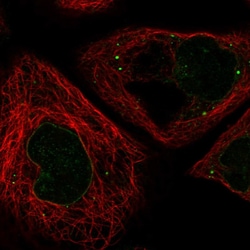 Invitrogen RNF6 Polyclonal Antibody 100 &mu;L; Unconjugated:Antibodies,