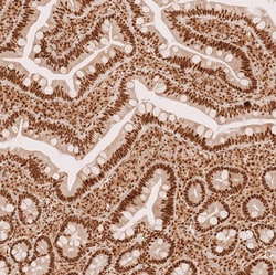 Invitrogen METTL4 Polyclonal Antibody 100 &mu;L; Unconjugated:Antibodies,