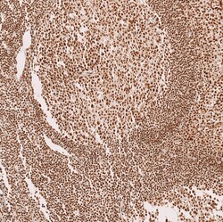 Invitrogen METTL4 Polyclonal Antibody 100 &mu;L; Unconjugated:Antibodies,