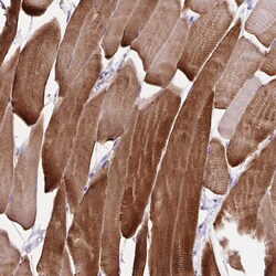 Invitrogen SYNM Polyclonal Antibody 100 &mu;L; Unconjugated:Antibodies,
