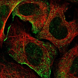 Invitrogen MYO9A Polyclonal Antibody 100 &mu;L; Unconjugated:Antibodies,