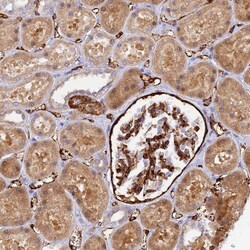 Invitrogen MYO9A Polyclonal Antibody 100 &mu;L; Unconjugated:Antibodies,