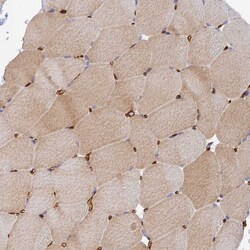 Invitrogen MYO9A Polyclonal Antibody 100 &mu;L; Unconjugated:Antibodies,