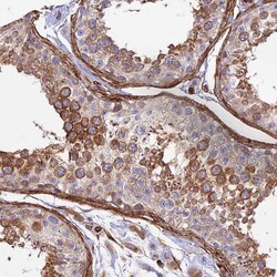 Invitrogen MYO9A Polyclonal Antibody 100 &mu;L; Unconjugated:Antibodies,