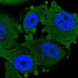 Invitrogen CHURC1 Polyclonal Antibody 100 &mu;L; Unconjugated:Antibodies,