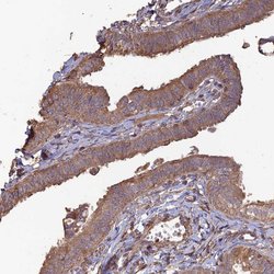 Invitrogen Layilin Polyclonal Antibody 100 &mu;L; Unconjugated:Anticuerpos