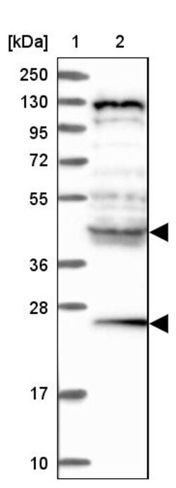 Invitrogen HYI Polyclonal Antibody 100 &mu;L; Unconjugated:Anticorps, Polyclonal