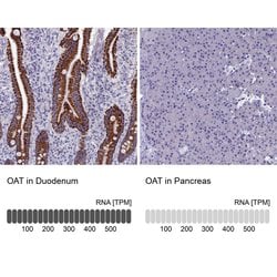 OAT Polyclonal Antibody:Antibodies, Polyclonal