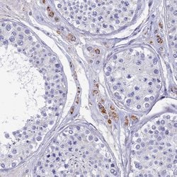 OAT Polyclonal Antibody:Antibodies, Polyclonal