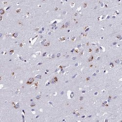 OAT Polyclonal Antibody:Antibodies, Polyclonal