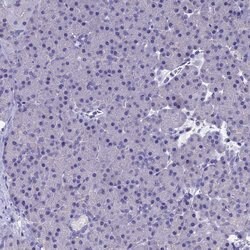 OAT Polyclonal Antibody:Antibodies, Polyclonal