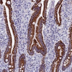 OAT Polyclonal Antibody:Antibodies, Polyclonal