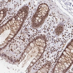 Invitrogen H1FX Polyclonal Antibody 100 &mu;L; Unconjugated:Antibodies,