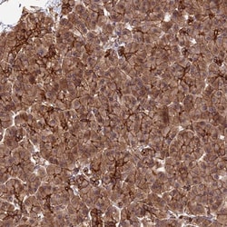 HOMER2 Polyclonal Antibody:Antibodies, Polyclonal