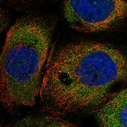 Invitrogen NAA16 Polyclonal Antibody 100 &mu;L | Buy Online | Invitrogen&trade; | Fisher Scientific