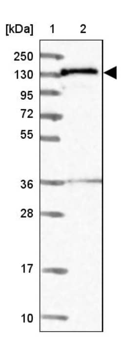 Invitrogen NAA16 Polyclonal Antibody 100 &mu;L | Buy Online | Invitrogen&trade; | Fisher Scientific