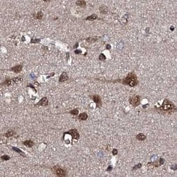 Invitrogen CSTF3 Polyclonal Antibody 100 &mu;L | Buy Online | Invitrogen&trade; | Fisher Scientific