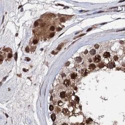 Invitrogen CSTF3 Polyclonal Antibody 100 &mu;L | Buy Online | Invitrogen&trade; | Fisher Scientific