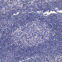 Invitrogen SPON2 Polyclonal Antibody 100 &mu;L; Unconjugated:Antibodies,