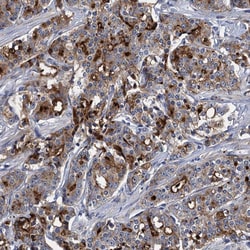 Invitrogen SPON2 Polyclonal Antibody 100 &mu;L; Unconjugated:Antibodies,