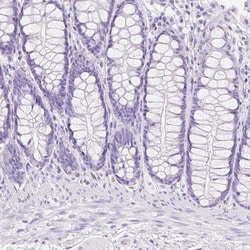 Invitrogen TGM1 Polyclonal Antibody 100 &mu;L; Unconjugated:Antibodies,