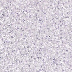 Invitrogen TGM1 Polyclonal Antibody 100 &mu;L; Unconjugated:Antibodies,