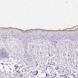 Invitrogen TGM1 Polyclonal Antibody 100 &mu;L; Unconjugated:Antibodies,