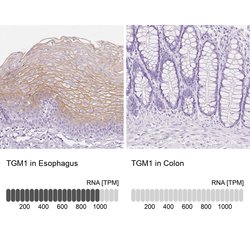 Invitrogen TGM1 Polyclonal Antibody 100 &mu;L; Unconjugated:Antibodies,