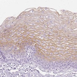 Invitrogen TGM1 Polyclonal Antibody 100 &mu;L; Unconjugated:Antibodies,