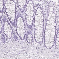Invitrogen TGM1 Polyclonal Antibody 100 &mu;L; Unconjugated:Antibodies,