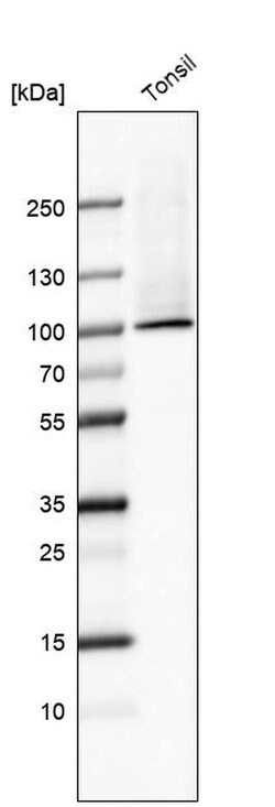 Invitrogen TGM1 Polyclonal Antibody 100 &mu;L; Unconjugated:Antibodies,