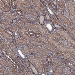 Invitrogen USPL1 Polyclonal Antibody 100 &mu;L; Unconjugated:Antibodies,