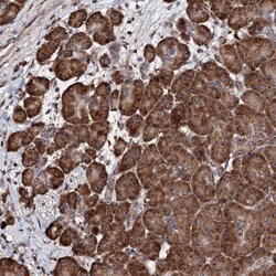Invitrogen FAM111A Polyclonal Antibody 100 &mu;L; Unconjugated:Antibodies,
