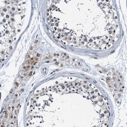 Invitrogen FAM222A Polyclonal Antibody 100 &mu;L; Unconjugated:Antibodies,