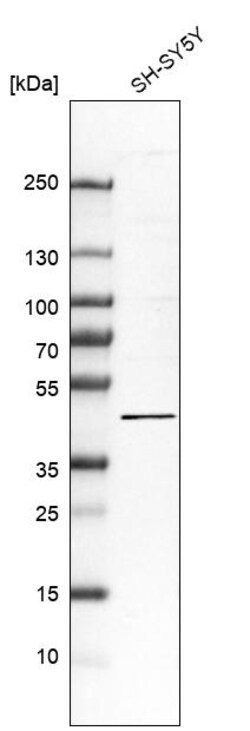 Invitrogen FAM222A Polyclonal Antibody 100 &mu;L | Buy Online | Invitrogen&trade; | Fisher Scientific
