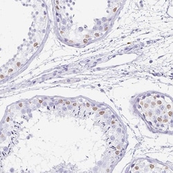 Invitrogen TPSD1 Polyclonal Antibody 100 &mu;L; Unconjugated:Antibodies,