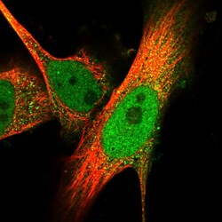 Invitrogen SPATA13 Polyclonal Antibody 100 &mu;L; Unconjugated:Antibodies,